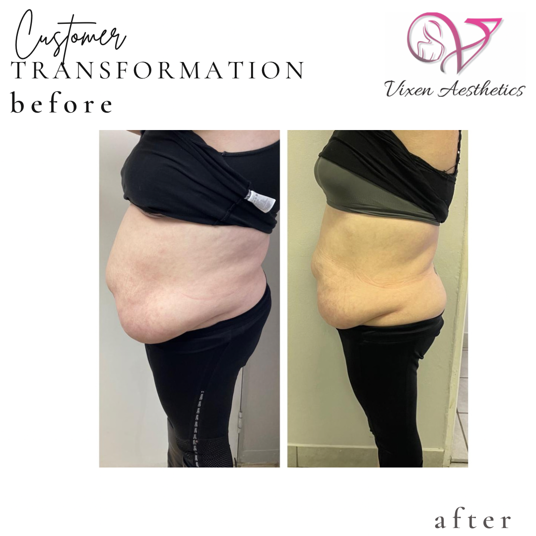 134BF960-4BCC-4D61-88C8-C6E39EDE512C