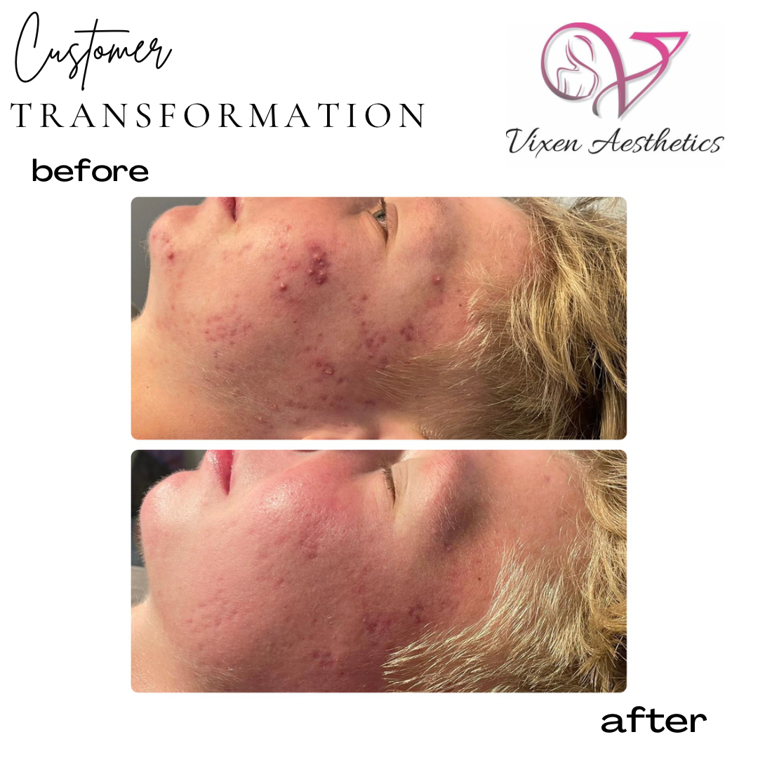 1BE62523-F144-41A1-A632-4DDDDF45C1C2