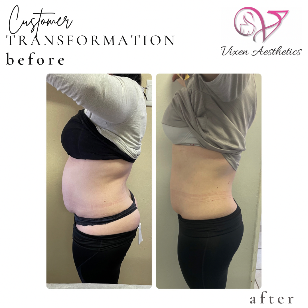 1D080729-03B7-4526-B516-CED3C272B24E