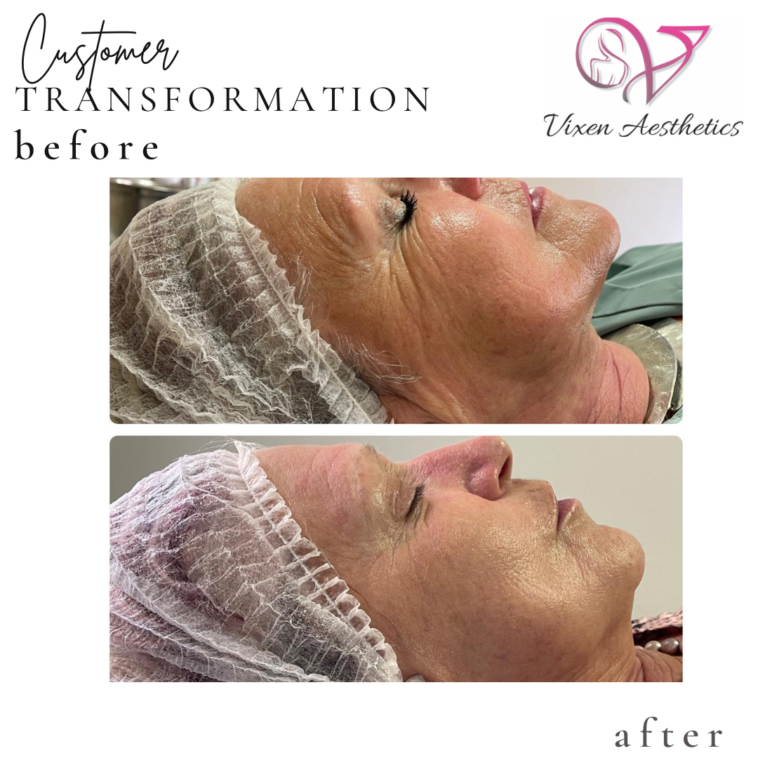 3778DC2D-D0D7-4C7C-AC45-05470431CB49