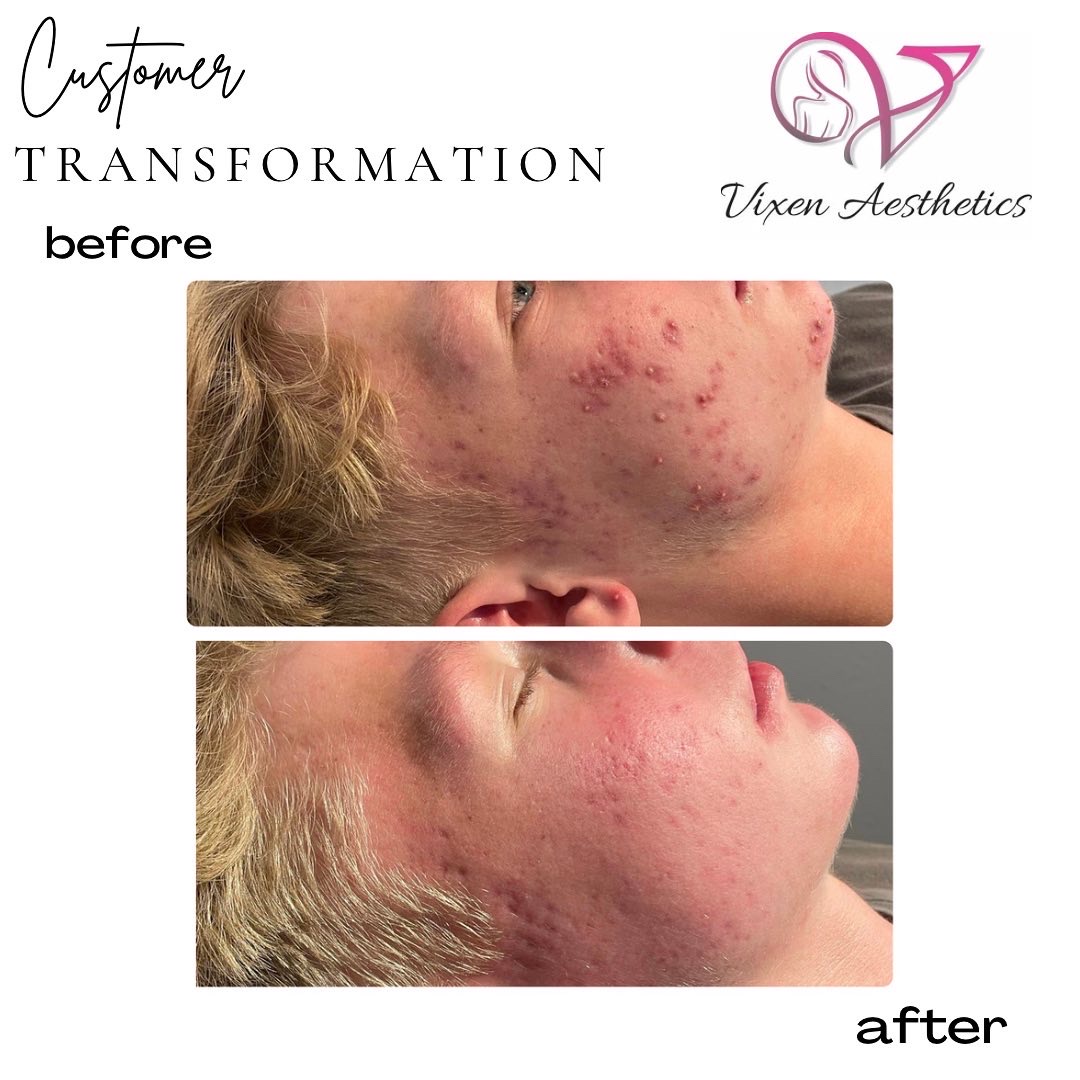 455FA956-5EB4-44D4-AF09-30C0B0F30316