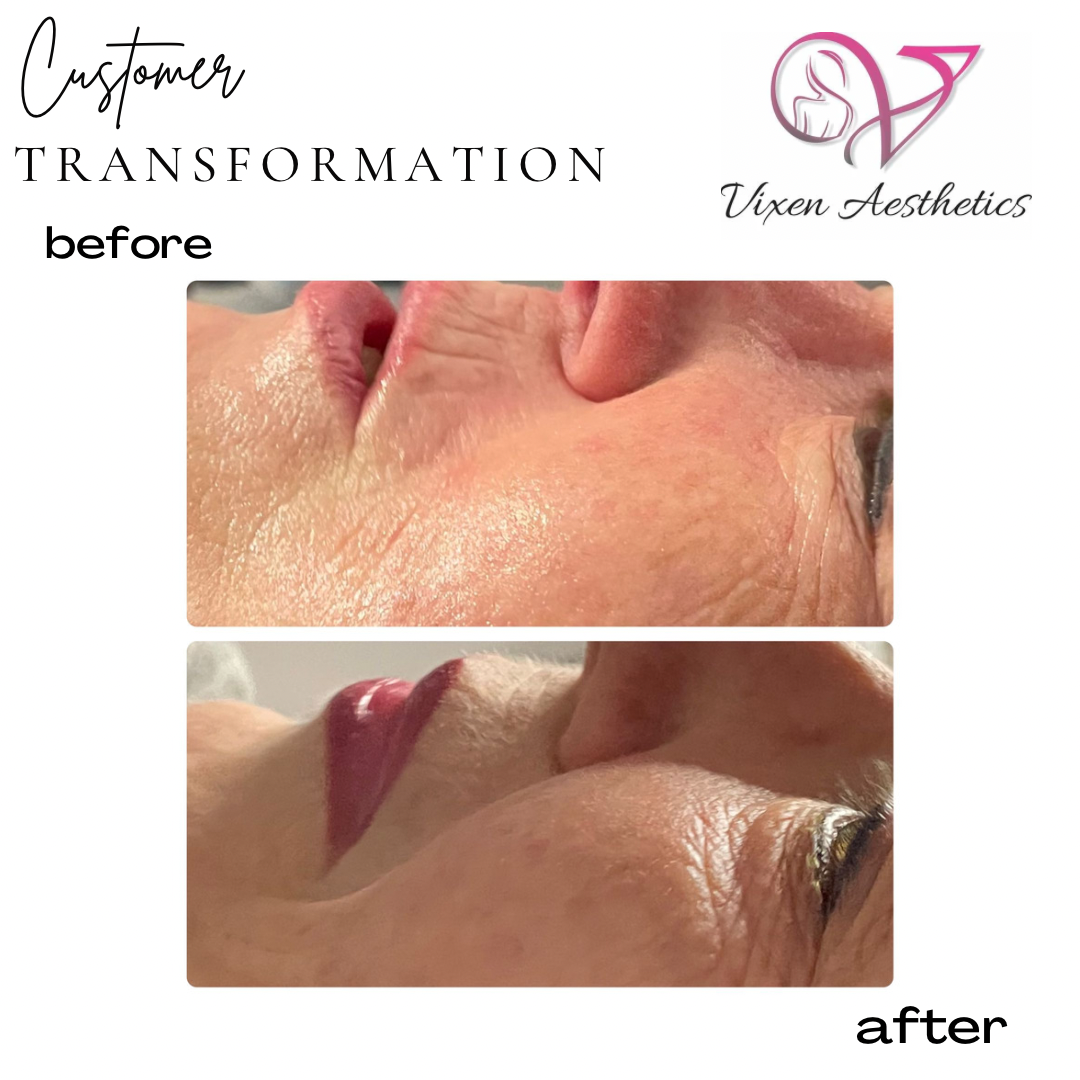 49A8A866-34EA-4A78-B918-2388F8E8015C