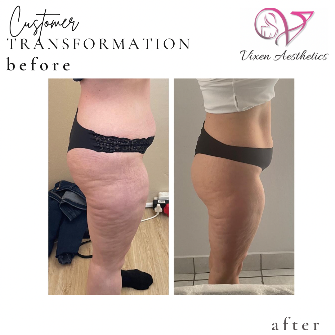 4D9FAFF5-A198-4A53-AB30-5A7322241D35