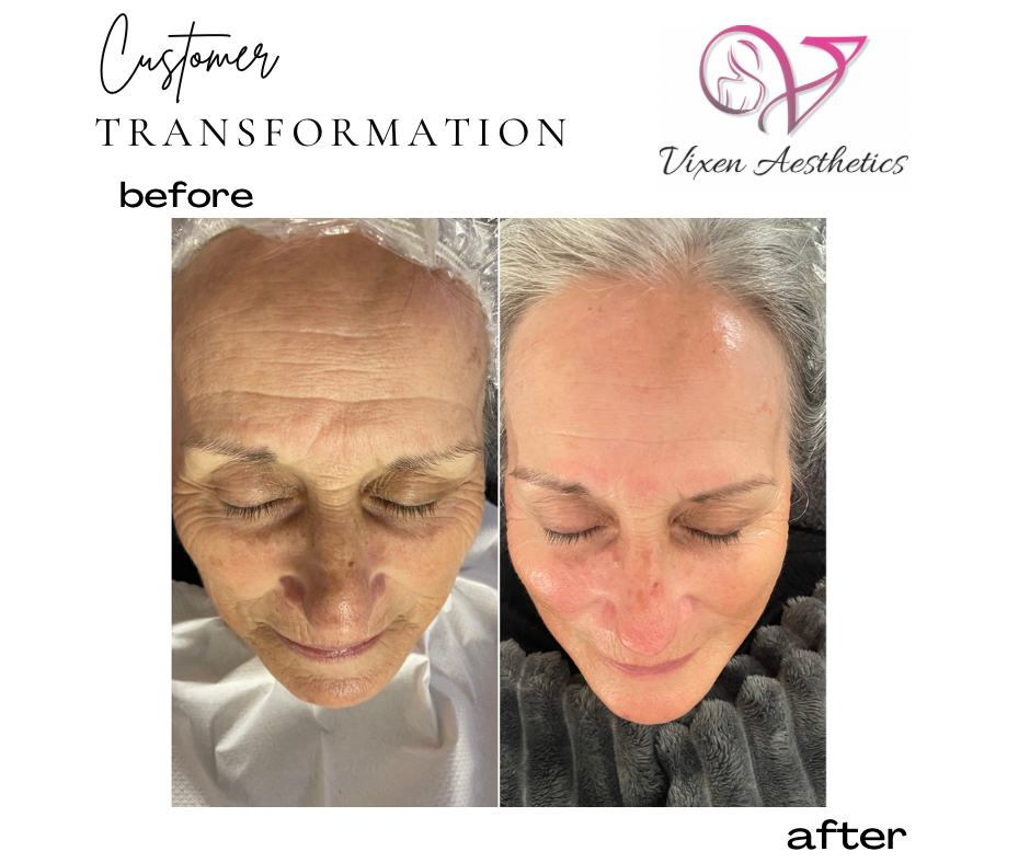 5C267D56-0B29-4CED-8284-366706F0EE6D