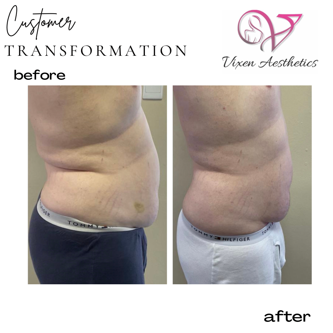 65FE4635-FEA3-411C-B225-89A435FAE9C4