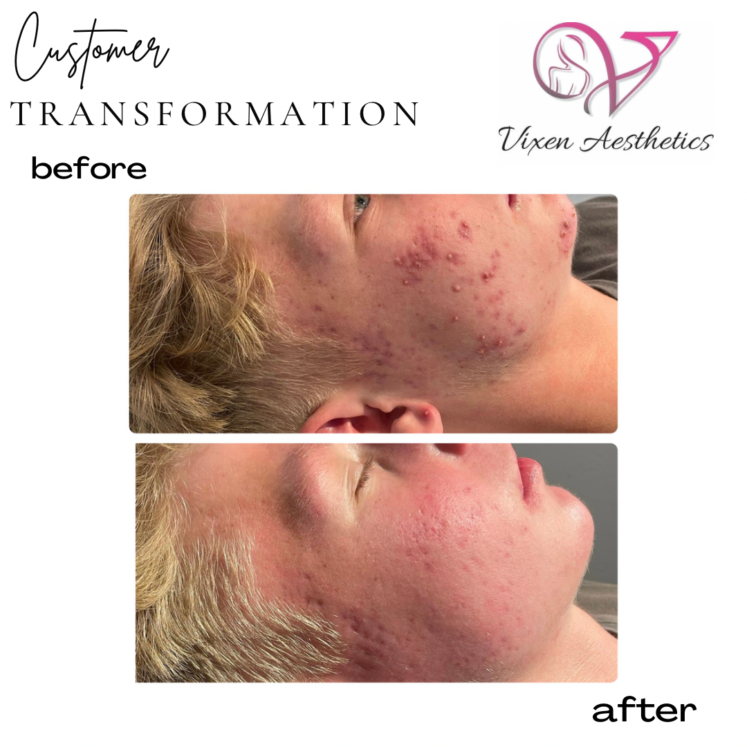 7FBA536F-6103-4FD8-B6E5-A3D22FB90D78