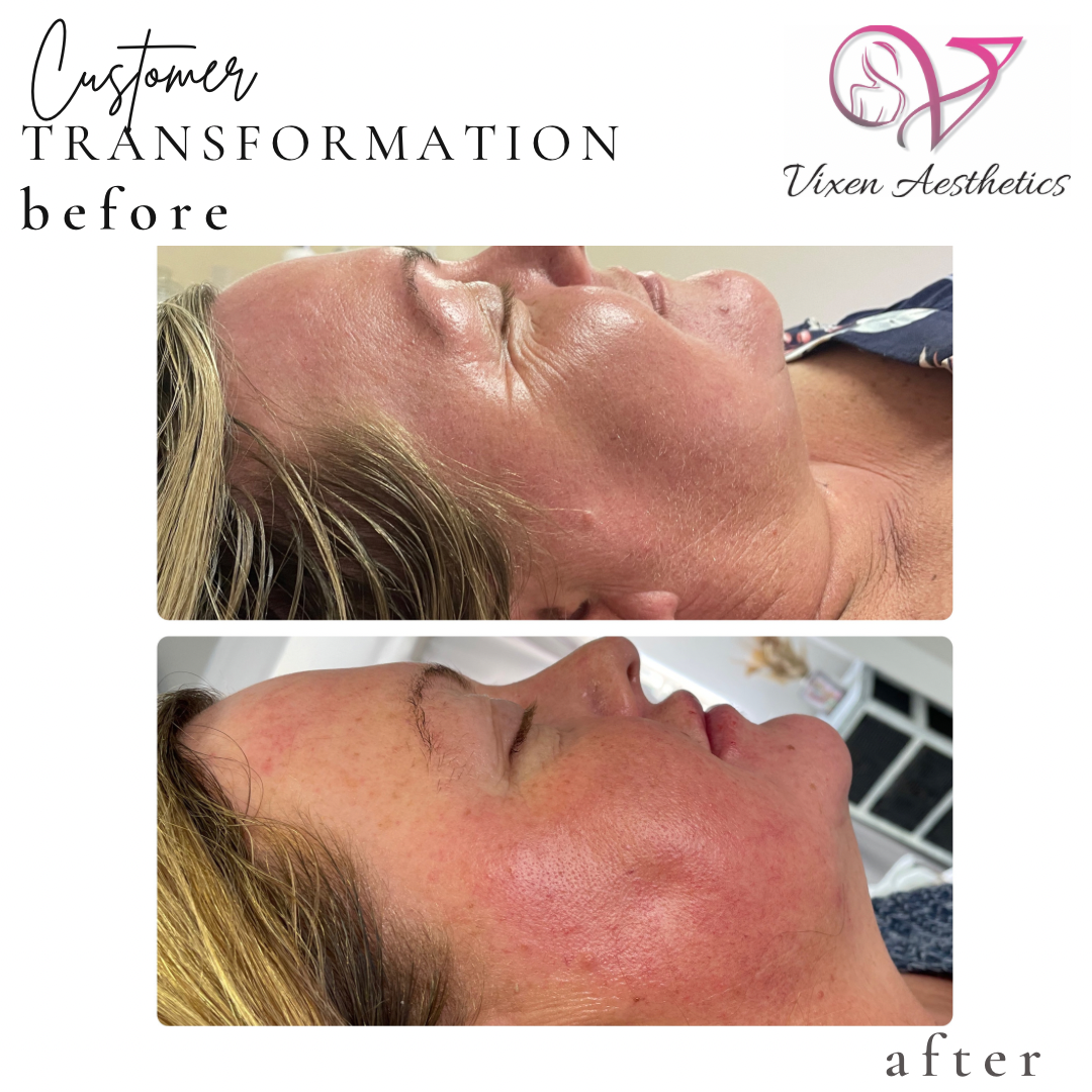 87C247B5-E565-45E5-975D-6249CED4ACD6