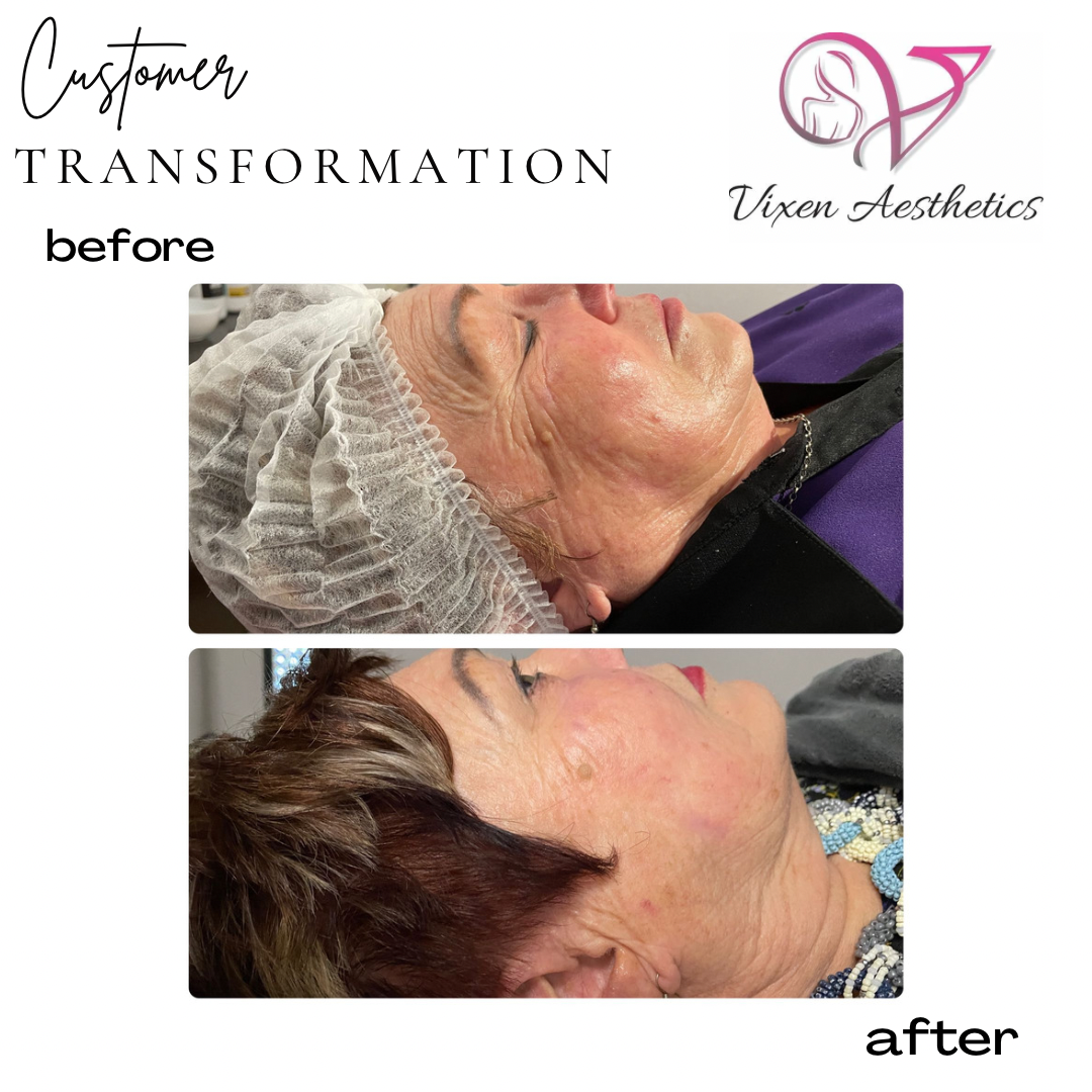 8B3ADD18-C975-466B-9681-1E39A89EA506