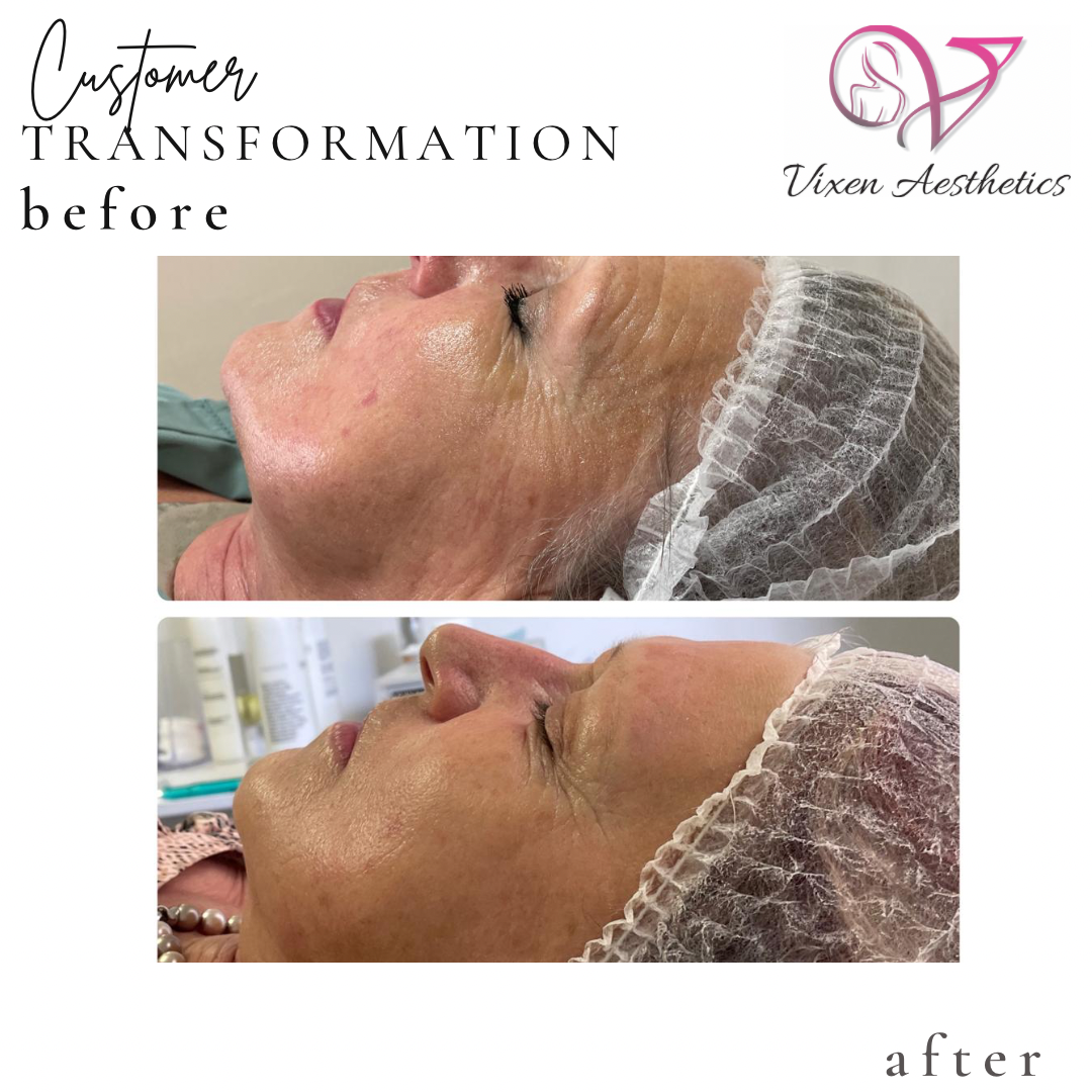 9202FE37-E4FA-48BA-B9A1-69E54B936421