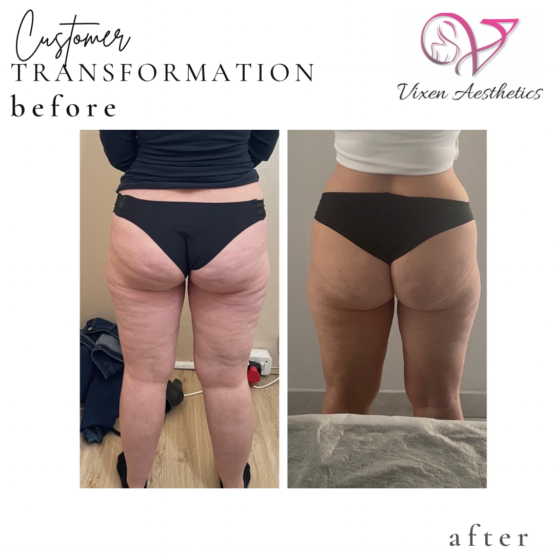 A1B0EF22-A455-4994-801A-4CDDADBF3CF0