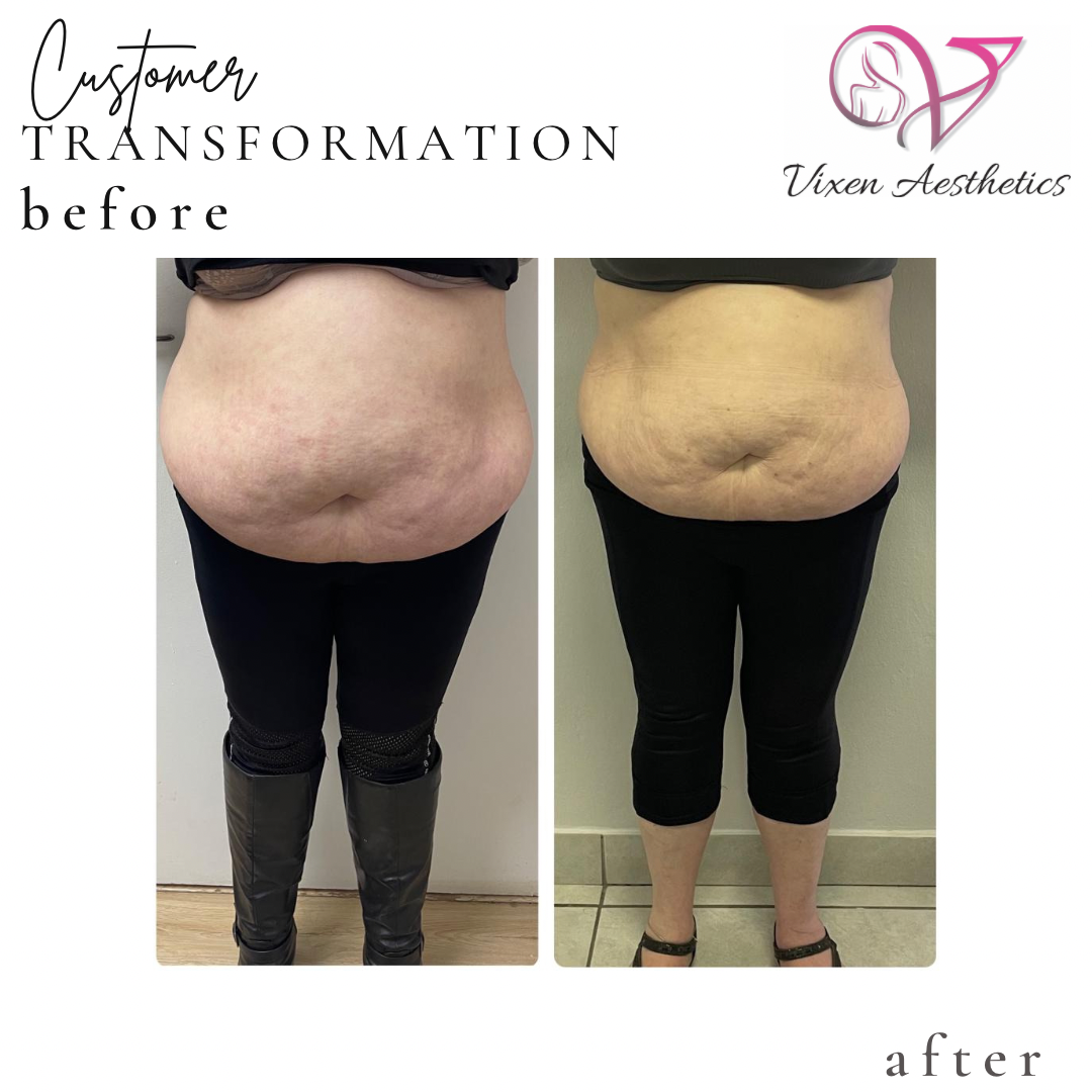 AF5E7B23-7074-45DC-A574-91E0372C25FD