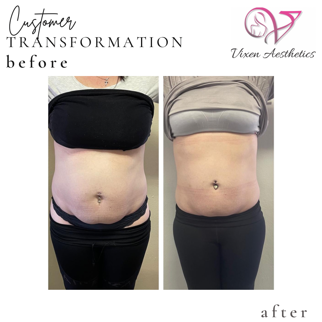 B25BE626-8449-4295-9D31-80131CE91229