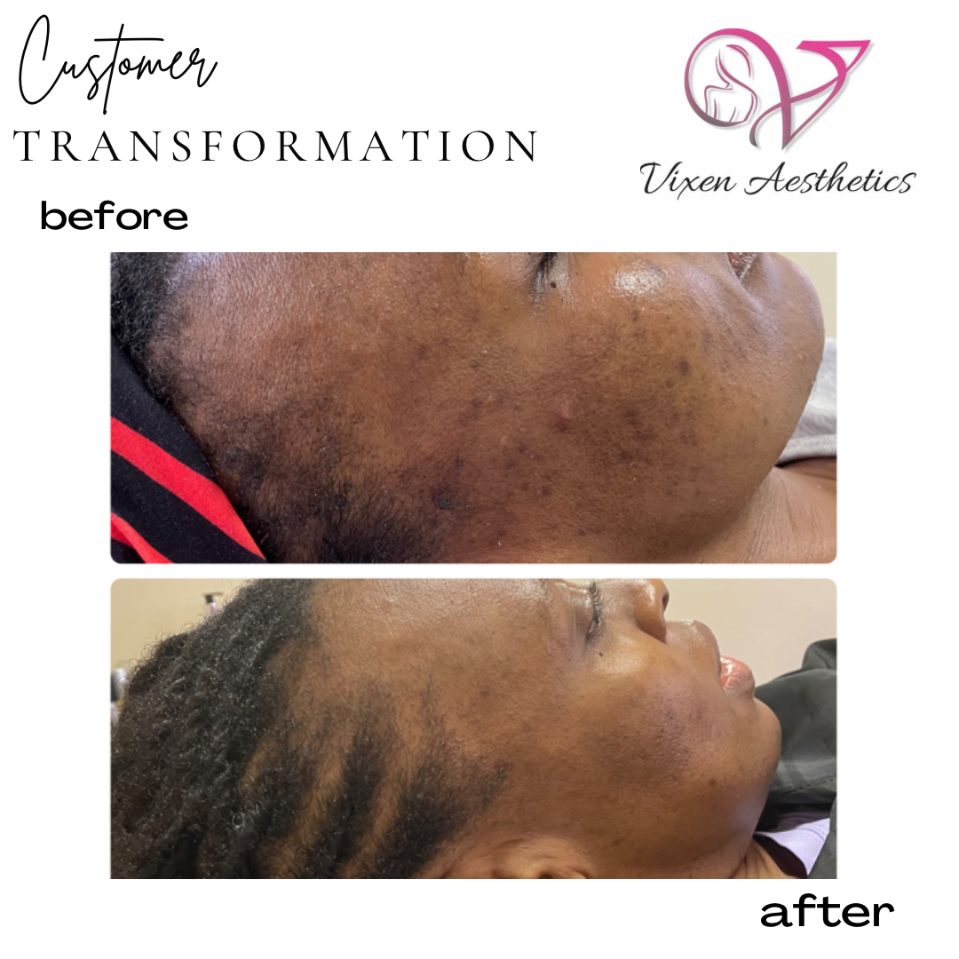 BDBF0204-7934-4271-A40D-7D694B799EFC