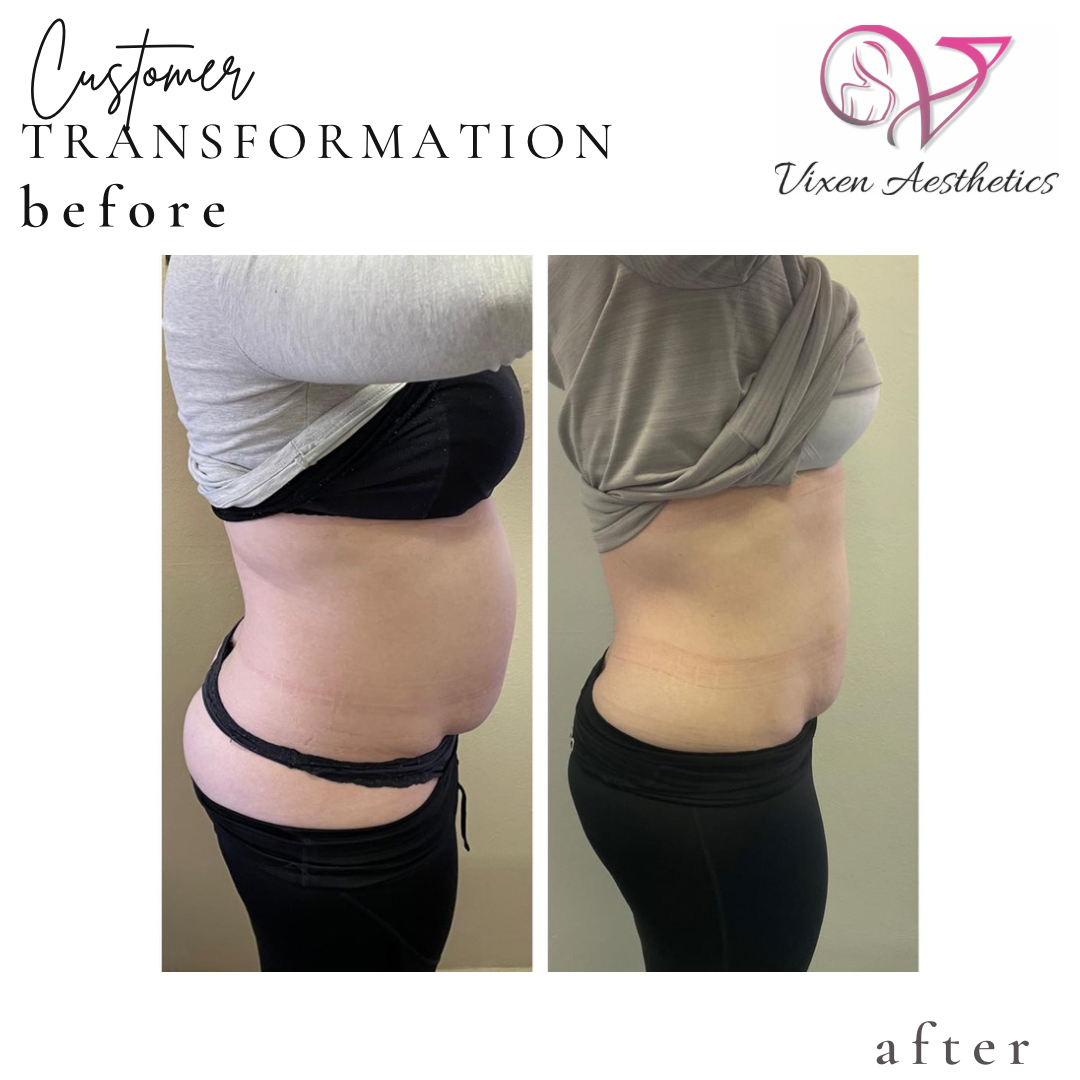 BDC2E9B1-F97A-4761-922E-642405D9FF95