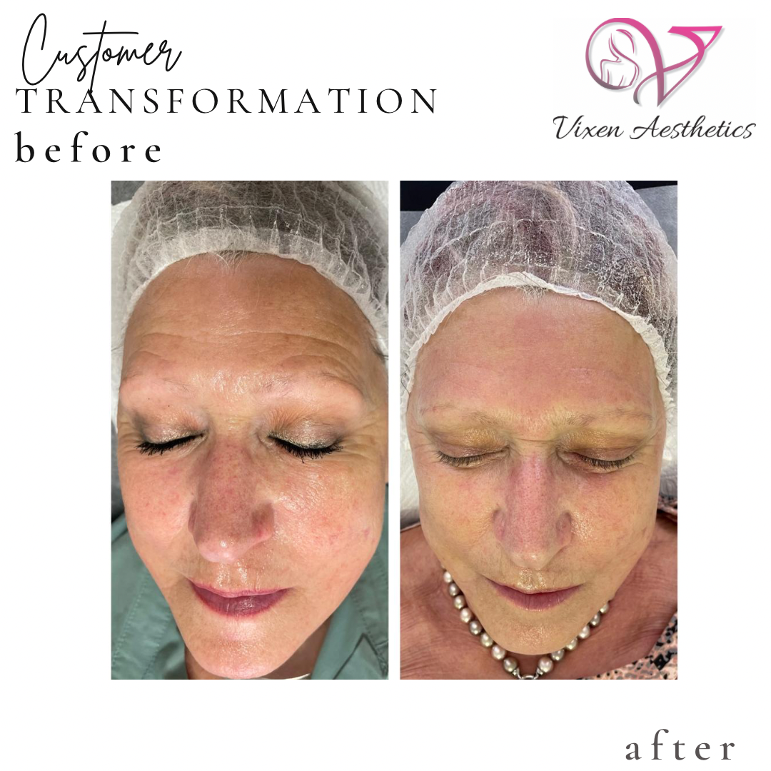 BEC99F38-02E8-455E-9F20-D6051BB110FC