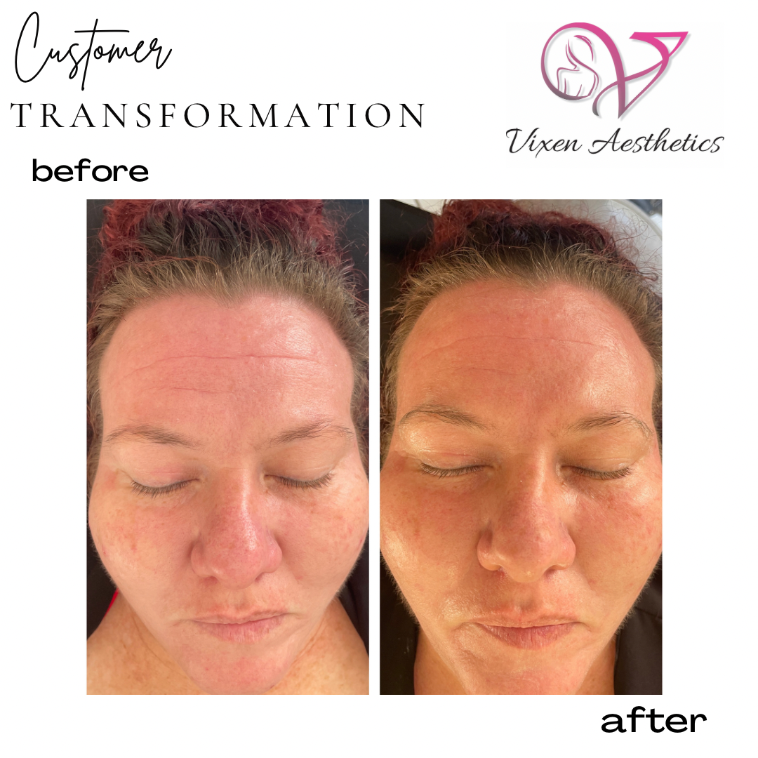 C8451987-31B3-442F-863D-0AC4733E4BE5