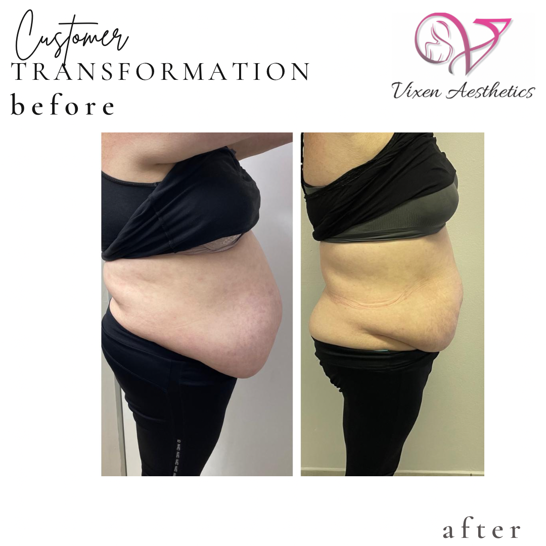 CADC8262-CF7D-4555-96AD-BD9DC3E04D53