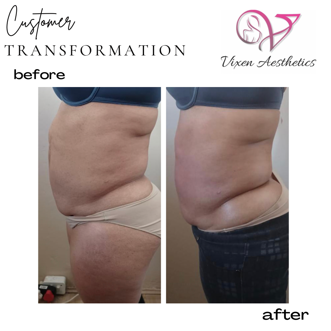 CD919EE6-A1C6-43C2-9EA2-06A33D2233C1