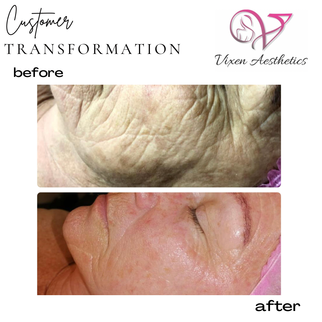 D615C956-C534-4194-8D5A-C2E467130A28