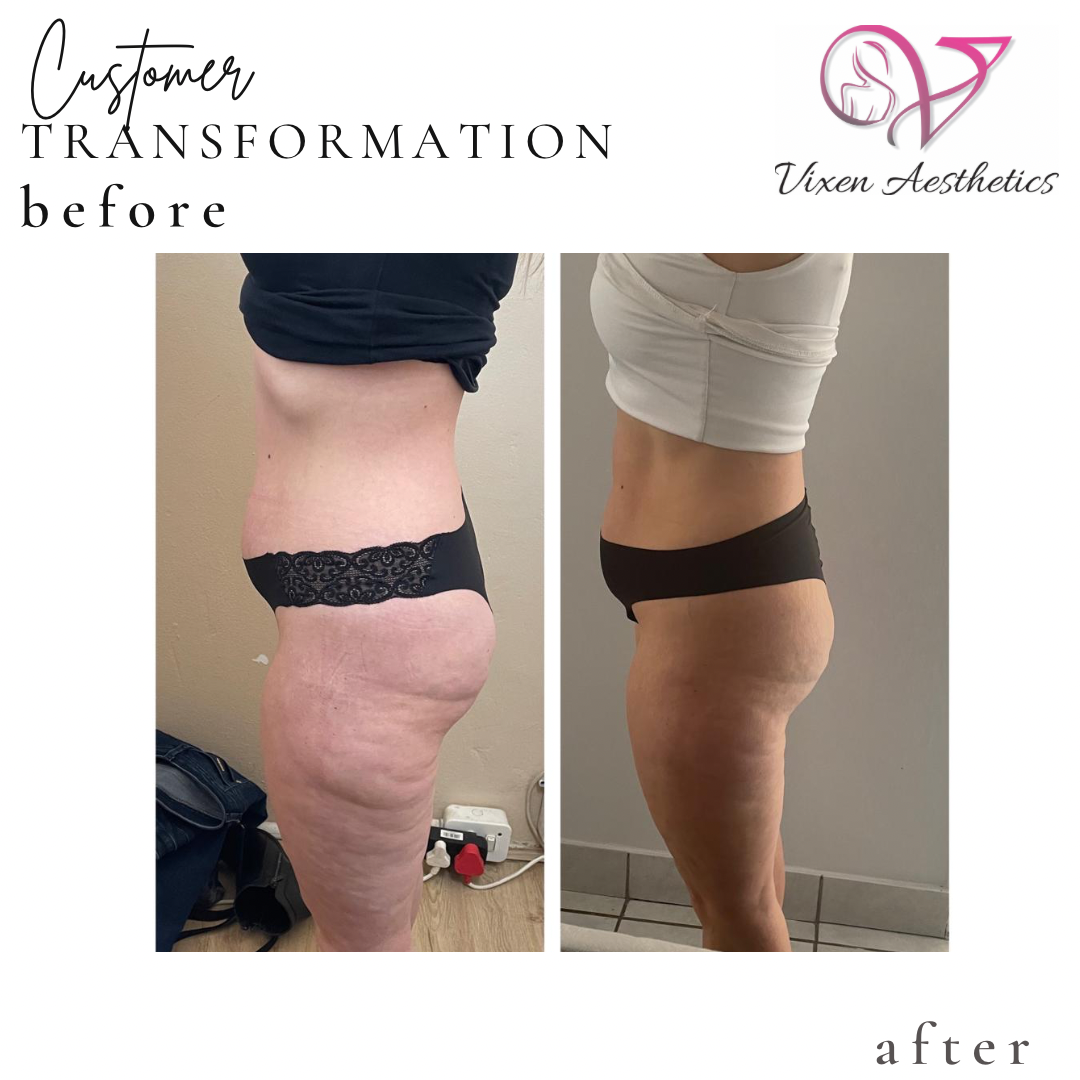 E33B02B5-6F6C-4680-A202-39D612F94D6A