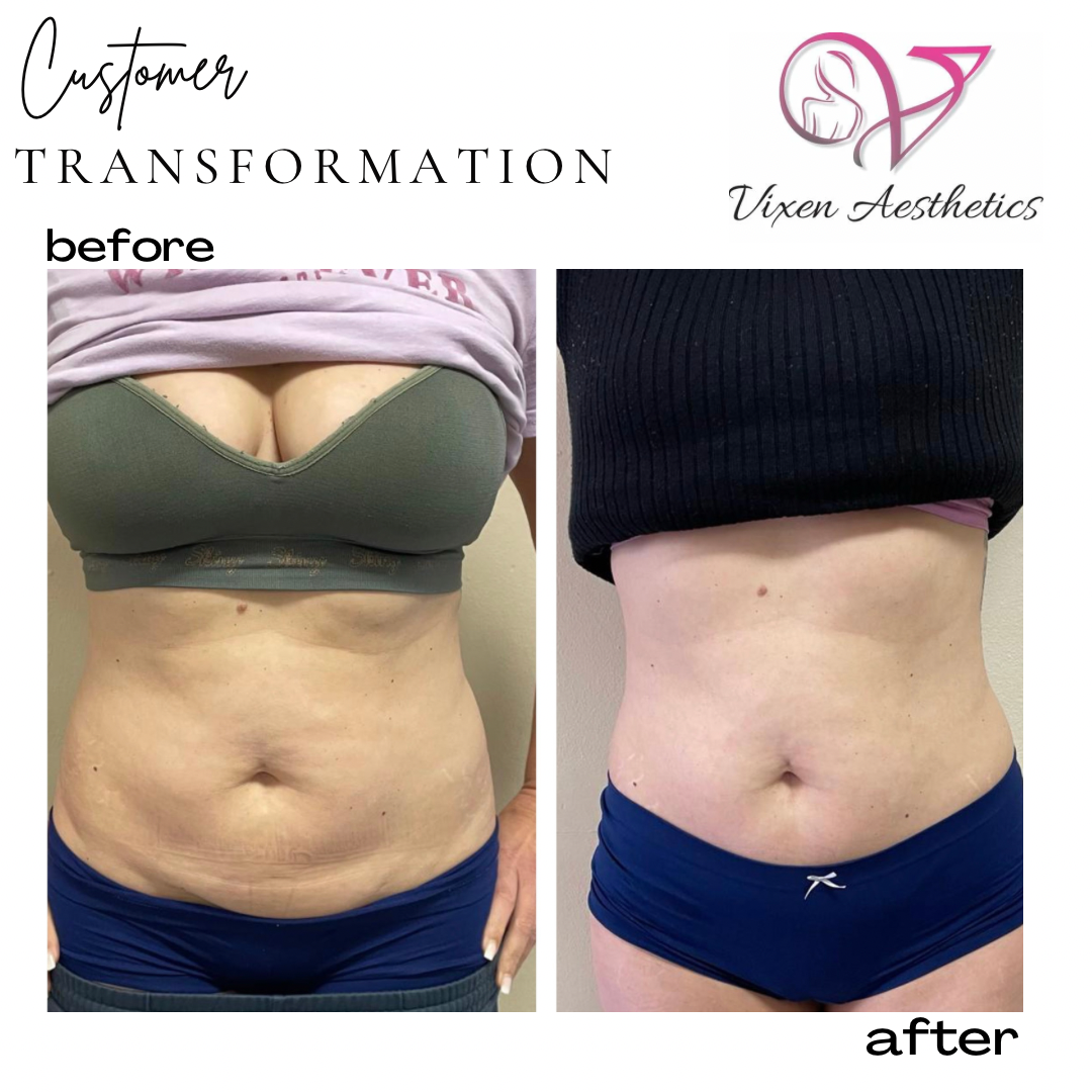 E5329A43-4203-4BFA-8483-40B268C254A4