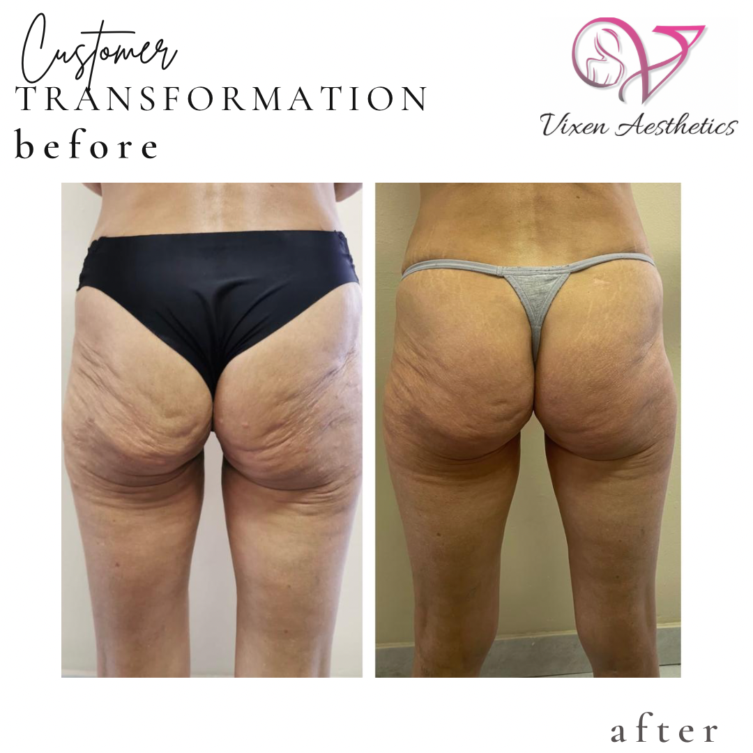 F6FC3AAD-0B97-4E1E-A7AF-E6FDF734E193